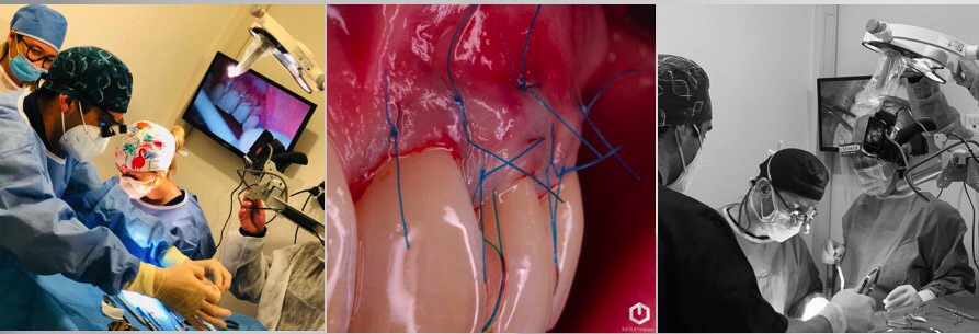 formation chirurgie plastique parodontale