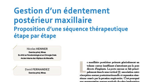 gestion d'un édentement postérieur maxillaire