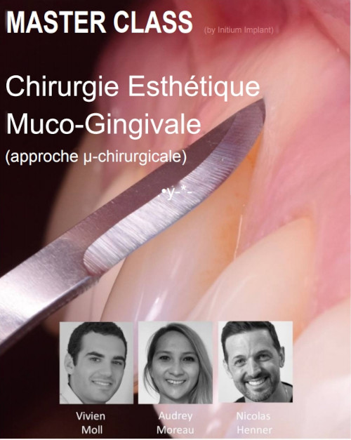 Formation chirurgie plastique parodontale