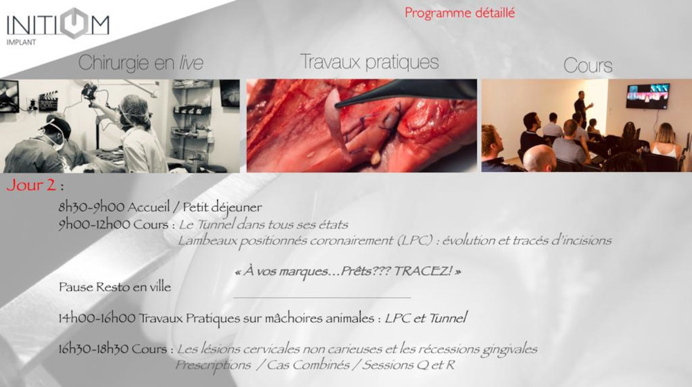 formations muco gingivale Gard